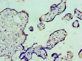 Immunohistochemistry of paraffin-embedded human placenta tissue using VTN Antibody at dilution of 1:100Rabbit anti-Human VTN Polyclonal Antibody
