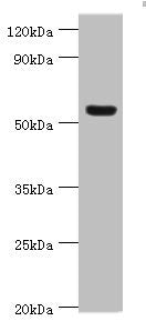 Western blot | All lanes: Vitronectin antibody at 12μg/ml + HepG2 whole cell lysate | Secondary | Goat polyclonal to rabbit IgG at 1/10000 dilution | Predicted band size: 54 kDa | Observed band size: 54 kDaRabbit anti-Human VTN Polyclonal Antibody