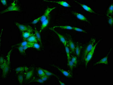 Immunofluorescence staining of Hela cells with WAS Antibody at 1:150, counter-stained with DAPI. The cells were fixed in 4% formaldehyde, permeabilized using 0.2% Triton X-100 and blocked in 10% normal Goat Serum. The cells were then incubated with the antibody overnight at 4°C. The secondary antibody was Alexa Fluor 488-congugated AffiniPure Goat Anti-Rabbit IgG(H+L).Rabbit anti-Human WAS Polyclonal Antibody