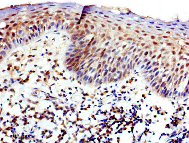 IHC image of WAS Antibody diluted at 1:400 and staining in paraffin-embedded human tonsil tissue performed on a Leica BondTM system. After dewaxing and hydration, antigen retrieval was mediated by high pressure in a citrate buffer (pH 6.0). Section was blocked with 10% normal goat serum 30min at RT. Then primary antibody (1% BSA) was incubated at 4°C overnight. The primary is detected by a biotinylated secondary antibody and visualized using an HRP conjugated SP system.Rabbit anti-Human WAS Polyclonal Antibody