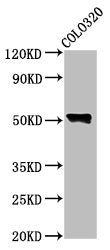 Western Blot  | Positive WB detected in: Colo320 whole cell lysate  | All lanes: WAS antibody at 4.6µg/ml  | Secondary  | Goat polyclonal to rabbit IgG at 1/50000 dilution  | Predicted band size: 53 kDa  | Observed band size: 53 kDaRabbit anti-Human WAS Polyclonal Antibody