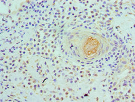 Immunohistochemistry of paraffin-embedded human breast tissue using WDR5 Antibody at dilution of 1:100Rabbit anti-Human WDR5 Polyclonal Antibody