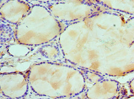 Immunohistochemistry of paraffin-embedded human thyroid tissue using WDR5 Antibody at dilution of 1:100Rabbit anti-Human WDR5 Polyclonal Antibody