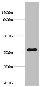 Western blot  | All lanes: WDR5 antibody at 2µg/ml + A431 whole cell lysate  | Secondary  | Goat polyclonal to rabbit IgG at 1/10000 dilution  | Predicted band size: 37 kDa  | Observed band size: 37 kDaRabbit anti-Human WDR5 Polyclonal Antibody