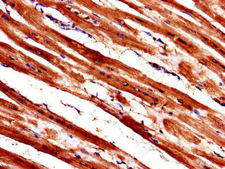 Immunohistochemistry of paraffin-embedded human heart tissue using WISP1 Antibody at dilution of 1:100Rabbit anti-Human WISP1 Polyclonal Antibody
