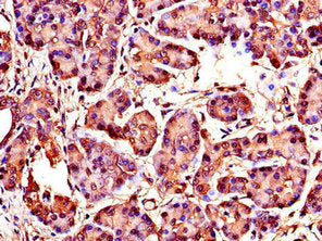 Immunohistochemistry of paraffin-embedded human pancreatic tissue using WISP1 Antibody at dilution of 1:100Rabbit anti-Human WISP1 Polyclonal Antibody
