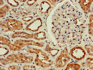 Immunohistochemistry of paraffin-embedded human kidney tissue using WISP3 Antibody at dilution of 1:100Rabbit anti-Human WISP3 Polyclonal Antibody