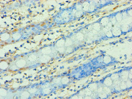 Immunohistochemistry of paraffin-embedded human colon tissue using WNT2 Antibody at dilution of 1:100