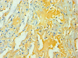 Immunohistochemistry of paraffin-embedded human lung tissue using WNT2 Antibody at dilution of 1:100
