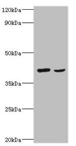 Western blot | All lanes: Protein Wnt-2 antibody at 2μg/ml | Lane 1: HepG2 whole cell lysate | Lane 2: MCF-7 whole cell lysate | Secondary | Goat polyclonal to rabbit IgG at 1/10000 dilution | Predicted band size: 40 kDa | Observed band size: 40 kDa