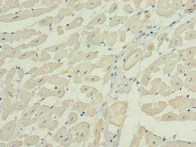 Immunohistochemistry of paraffin-embedded human heart tissue using WNT4 Antibody at dilution of 1:100Rabbit anti-Human WNT4 Polyclonal Antibody