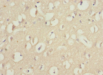 Immunohistochemistry of paraffin-embedded human brain tissue using WNT7B Antibody at dilution of 1:100Rabbit anti-Human WNT7B Polyclonal Antibody