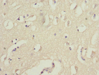 Immunohistochemistry of paraffin-embedded human brain tissue using WNT7B Antibody at dilution of 1:100Rabbit anti-Human WNT7B Polyclonal Antibody