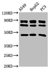 Western Blot | Positive WB detected in: A549 whole cell lysate, HepG2 whole cell lysate, PC-3 whole cell lysate | All lanes: WNT7B antibody at 2.2μg/ml | Secondary | Goat polyclonal to rabbit IgG at 1/50000 dilution | Predicted band size: 40 kDa | Observed band size: 47 kDaRabbit anti-Human WNT7B Polyclonal Antibody