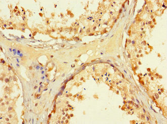 Immunohistochemistry of paraffin-embedded human testis tissue using WRB Antibody at dilution of 1:100Rabbit anti-Human WRB Polyclonal Antibody