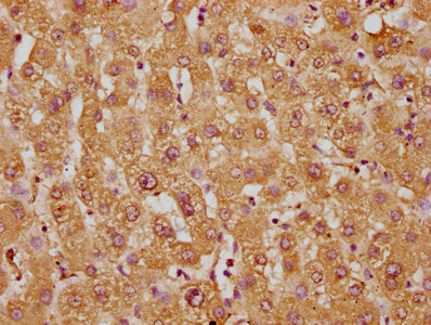 Immunohistochemistry of paraffin-embedded human liver tissue using WRB Antibody at dilution of 1:100Rabbit anti-Human WRB Polyclonal Antibody