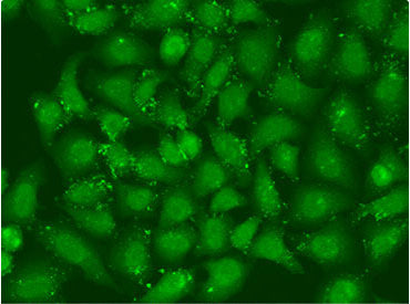 Immunofluorescent analysis of U2OS cells using XBP1 Antibody at dilution of 1:100 and Alexa Fluor 488-congugated AffiniPure Goat Anti-Rabbit IgG(H+L).Rabbit anti-Human XBP1 Polyclonal Antibody