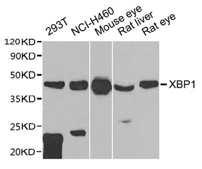 Western blot  | All lanes: XBP1 antibody at 1:1000 dilution  | Lane 1: 293T whole cell lysate  | Lane 2: NCI-H460 whole cell lysate  | Lane 3: Mouse eye tissue  | Lane 4: Rat liver tissue  | Lane 5: Rat eye tissue  | Secondary  | Goat polyclonal to rabbit IgG at 1/10000 dilution  | Predicted band size: 29, 41 kDa  | Observed band size: 41 kDaRabbit anti-Human XBP1 Polyclonal Antibody