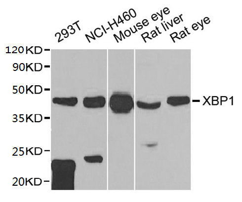 Western blot  | All lanes: XBP1 antibody at 1:1000 dilution  | Lane 1: 293T whole cell lysate  | Lane 2: NCI-H460 whole cell lysate  | Lane 3: Mouse eye tissue  | Lane 4: Rat liver tissue  | Lane 5: Rat eye tissue  | Secondary  | Goat polyclonal to rabbit IgG at 1/10000 dilution  | Predicted band size: 29, 41 kDa  | Observed band size: 41 kDaRabbit anti-Human XBP1 Polyclonal Antibody