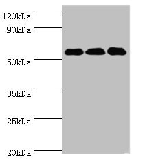 Western blot  | All lanes: XIAP antibody at 3µg/ml  | Lane 1: HepG2 whole cell lysate  | Lane 2: MCF-7 whole cell lysate  | Lane 3: PC-3 whole cell lysate  | Secondary  | Goat polyclonal to rabbit IgG at 1/10000 dilution  | Predicted band size: 57 kDa  | Observed band size: 57 kDaRabbit anti-Human XIAP Polyclonal Antibody