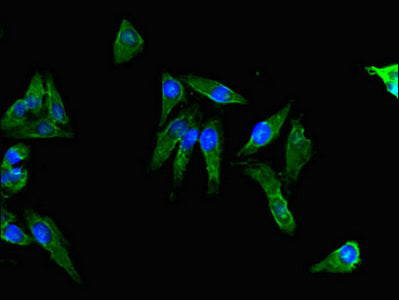 Immunofluorescent analysis of Hela cells using ACTG1 Antibody at dilution of 1:100 and Alexa Fluor 488-congugated AffiniPure Goat Anti-Rabbit IgG(H+L)