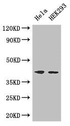 Western Blot | Positive WB detected in: Hela whole cell lysate, HEK293 whole cell lysate | All lanes: ACTG1 antibody at 3μg/ml | Secondary | Goat polyclonal to rabbit IgG at 1/50000 dilution | Predicted band size: 42 kDa | Observed band size: 42 kDa