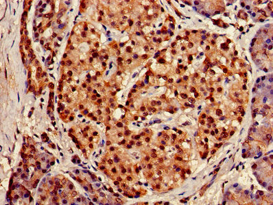 IHC image of XPO1 Antibody diluted at 1:150 and staining in paraffin-embedded human pancreatic tissue performed on a Leica BondTM system. After dewaxing and hydration, antigen retrieval was mediated by high pressure in a citrate buffer (pH 6.0). Section was blocked with 10% normal goat serum 30min at RT. Then primary antibody (1% BSA) was incubated at 4°C overnight. The primary is detected by a biotinylated secondary antibody and visualized using an HRP conjugated SP system.Rabbit anti-Human XPO1 Polyclonal Antibody