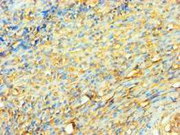 Immunohistochemistry of paraffin-embedded human tonsil tissue using XRCC5 Antibody at dilution of 1:100Rabbit anti-Human XRCC5 Polyclonal Antibody