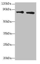 Western blot  | All lanes: XRCC5 antibody at 6µg/ml  | Lane 1: HepG2 whole cell lysate  | Lane 2: Hela whole cell lysate  | Secondary  | Goat polyclonal to rabbit IgG at 1/10000 dilution  | Predicted band size: 83 kDa  | Observed band size: 83 kDaRabbit anti-Human XRCC5 Polyclonal Antibody