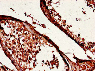 Immunohistochemistry of paraffin-embedded human testis tissue using YES1 Antibody at dilution of 1:100Rabbit anti-Human YES1 Polyclonal Antibody