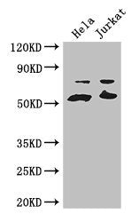 Western Blot | Positive WB detected in: Hela whole cell lysate, Jurkat whole cell lysate | All lanes: YES1 antibody at 3.2μg/ml | Secondary | Goat polyclonal to rabbit IgG at 1/50000 dilution | Predicted band size: 61 kDa | Observed band size: 61, 70 kDaRabbit anti-Human YES1 Polyclonal Antibody