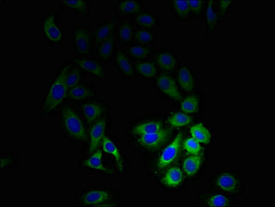 Immunofluorescent analysis of HepG2 cells using M6PR Antibody at dilution of 1:100 and Alexa Fluor 488-congugated AffiniPure Goat Anti-Rabbit IgG(H+L)