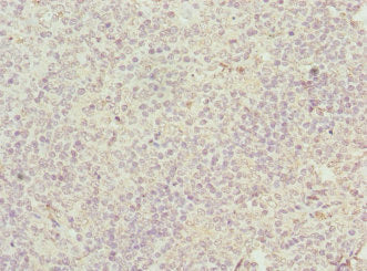 Immunohistochemistry of paraffin-embedded human tonsil tissue using M6PR Antibody at dilution of 1:100