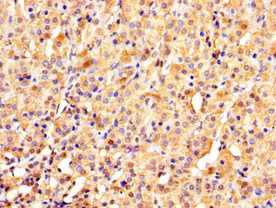 IHC image of YWHAE Antibody diluted at 1:1000 and staining in paraffin-embedded human adrenal gland tissue performed on a Leica BondTM system. After dewaxing and hydration, antigen retrieval was mediated by high pressure in a citrate buffer (pH 6.0). Section was blocked with 10% normal goat serum 30min at RT. Then primary antibody (1% BSA) was incubated at 4°C overnight. The primary is detected by a biotinylated secondary antibody and visualized using an HRP conjugated SP system.Rabbit anti-Human YWHAE Polyclonal Antibody