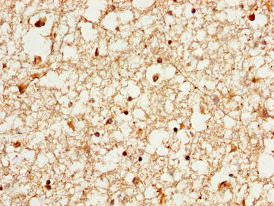 IHC image of YWHAE Antibody diluted at 1:1000 and staining in paraffin-embedded human brain tissue performed on a Leica BondTM system. After dewaxing and hydration, antigen retrieval was mediated by high pressure in a citrate buffer (pH 6.0). Section was blocked with 10% normal goat serum 30min at RT. Then primary antibody (1% BSA) was incubated at 4°C overnight. The primary is detected by a biotinylated secondary antibody and visualized using an HRP conjugated SP system.Rabbit anti-Human YWHAE Polyclonal Antibody