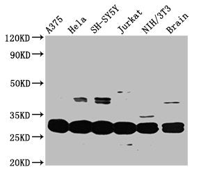 Western Blot  | Positive WB detected in: A375 whole cell lysate, Hela whole cell lysate, SH-SY5Y whole cell lysate, Jurkat whole cell lysate, NIH/3T3 whole cell lysate, Mouse brain tissue  | All lanes: YWHAE antibody at 3.3µg/ml  | Secondary  | Goat polyclonal to rabbit IgG at 1/50000 dilution  | Predicted band size: 30, 27 kDa  | Observed band size: 30 kDaRabbit anti-Human YWHAE Polyclonal Antibody