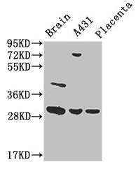 Western BlotPositive WB detected in: Mouse brain tissue, A431 whole cell lysate, Human placenta tissueAll lanes: YWHAG antibody at 1:2000SecondaryGoat polyclonal to rabbit IgG at 1/50000 dilutionPredicted band size: 29 kDaObserved band size: 29 kDaRabbit anti-Human YWHAG Polyclonal Antibody