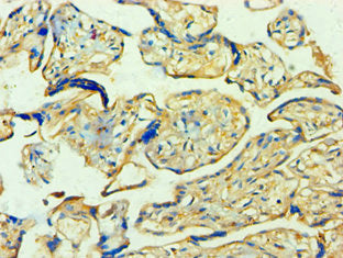 Immunohistochemistry of paraffin-embedded human placenta tissue using YWHAQ Antibody at dilution of 1:100Rabbit anti-Human YWHAQ Polyclonal Antibody