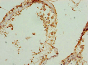 Immunohistochemistry of paraffin-embedded human testis tissue using ZBTB25 Antibody at dilution of 1:100Rabbit anti-Human ZBTB25 Polyclonal Antibody