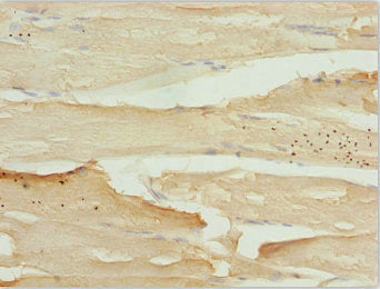 Immunohistochemistry of paraffin-embedded human skeletal muscle tissue using ZBTB25 Antibody at dilution of 1:100Rabbit anti-Human ZBTB25 Polyclonal Antibody