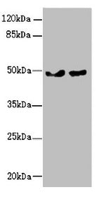 Western blot  | All lanes: ZBTB25 antibody at 0.43µg/ml  | Lane 1: MCF-7 whole cell lysate  | Lane 2: Hela whole cell lysate  | Secondary  | Goat polyclonal to rabbit IgG at 1/10000 dilution  | Predicted band size: 49 kDa  | Observed band size: 49 kDaRabbit anti-Human ZBTB25 Polyclonal Antibody
