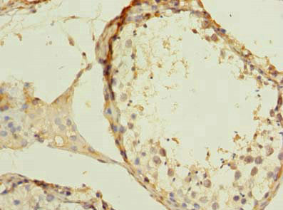 Immunohistochemistry of paraffin-embedded human testis tissue using the antibody at dilution of 1:100Rabbit anti-Human ZBTB43 Polyclonal Antibody