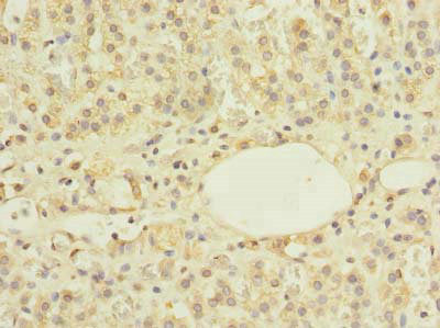 Immunohistochemistry of paraffin-embedded human adrenal gland tissue using ZBTB43 Antibody at dilution of 1:100Rabbit anti-Human ZBTB43 Polyclonal Antibody