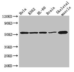 Western Blot  | Positive WB detected in: Hela whole cell lysate, K562 whole cell lysate, HL60 whole cell lysate, Mouse brain tissue, Mouse skeletal muscle tissue  | All lanes: ZBTB43 antibody at 3µg/ml  | Secondary  | Goat polyclonal to rabbit IgG at 1/50000 dilution  | Predicted band size: 53 kDa  | Observed band size: 53 kDaRabbit anti-Human ZBTB43 Polyclonal Antibody