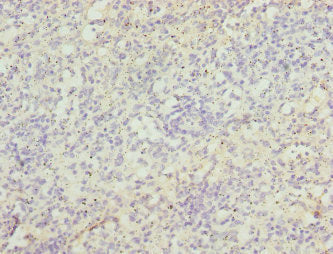 Immunohistochemistry of paraffin-embedded human spleen tissue using ZBTB48 Antibody at dilution of 1:100Rabbit anti-Human ZBTB48 Polyclonal Antibody