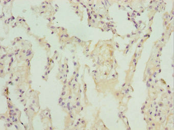 Immunohistochemistry of paraffin-embedded human lung tissue using ZBTB48 Antibody at dilution of 1:100Rabbit anti-Human ZBTB48 Polyclonal Antibody
