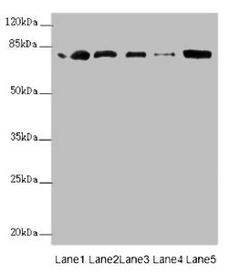 Western blot  | All lanes: ZBTB48 antibody at 0.31µg/ml  | Lane 1: 293T whole cell lysate  | Lane 2: K562 whole cell lysate  | Lane 3: HepG2 whole cell lysate  | Lane 4: U251 whole cell lysate  | Lane 5: Mouse liver tissue  | Secondary  | Goat polyclonal to rabbit IgG at 1/10000 dilution  | Predicted band size: 77 kDa  | Observed band size: 77 kDaRabbit anti-Human ZBTB48 Polyclonal Antibody