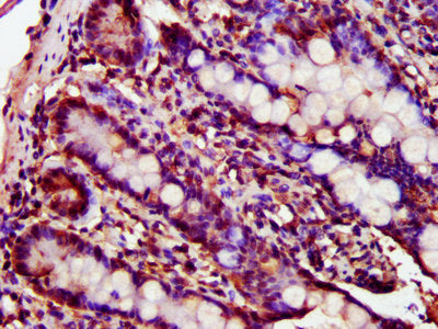 IHC image of LGALS9 Antibody diluted at 1:300 and staining in paraffin-embedded human small intestine tissue performed on a Leica BondTM system. After dewaxing and hydration, antigen retrieval was mediated by high pressure in a citrate buffer (pH 6.0). Section was blocked with 10% normal goat serum 30min at RT. Then primary antibody (1% BSA) was incubated at 4°C overnight. The primary is detected by a biotinylated secondary antibody and visualized using an HRP conjugated SP system.