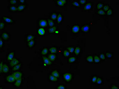 Immunofluorescent analysis of PC-3 cells using ZMPSTE24 Antibody at dilution of 1:100 and Alexa Fluor 488-congugated AffiniPure Goat Anti-Rabbit IgG(H+L)Rabbit anti-Human ZMPSTE24 Polyclonal Antibody