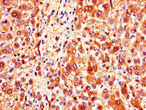 Immunohistochemistry of paraffin-embedded human liver tissue using the antibody at dilution of 1:100Rabbit anti-Human ZMPSTE24 Polyclonal Antibody